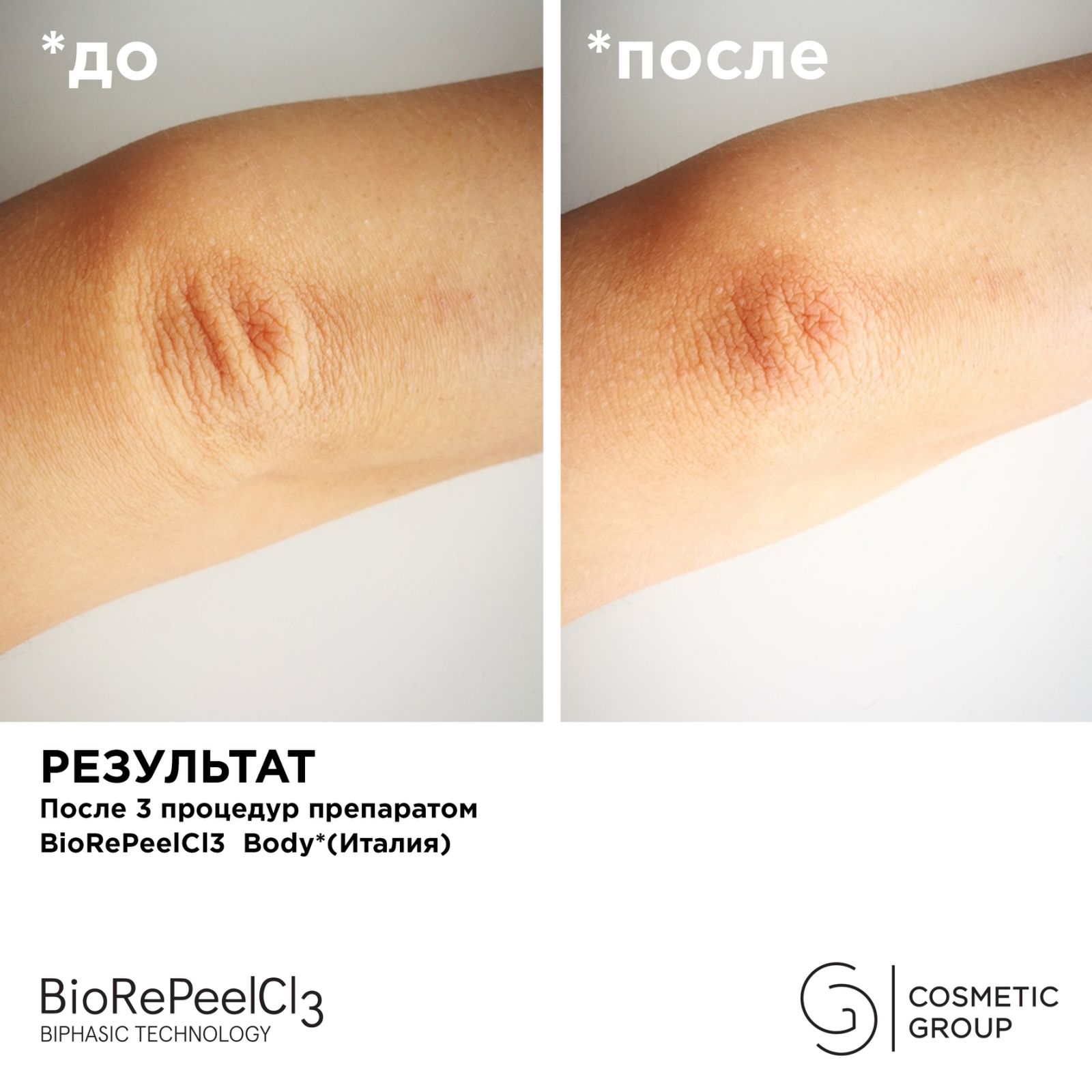 Пилинг BioRePeelCL3