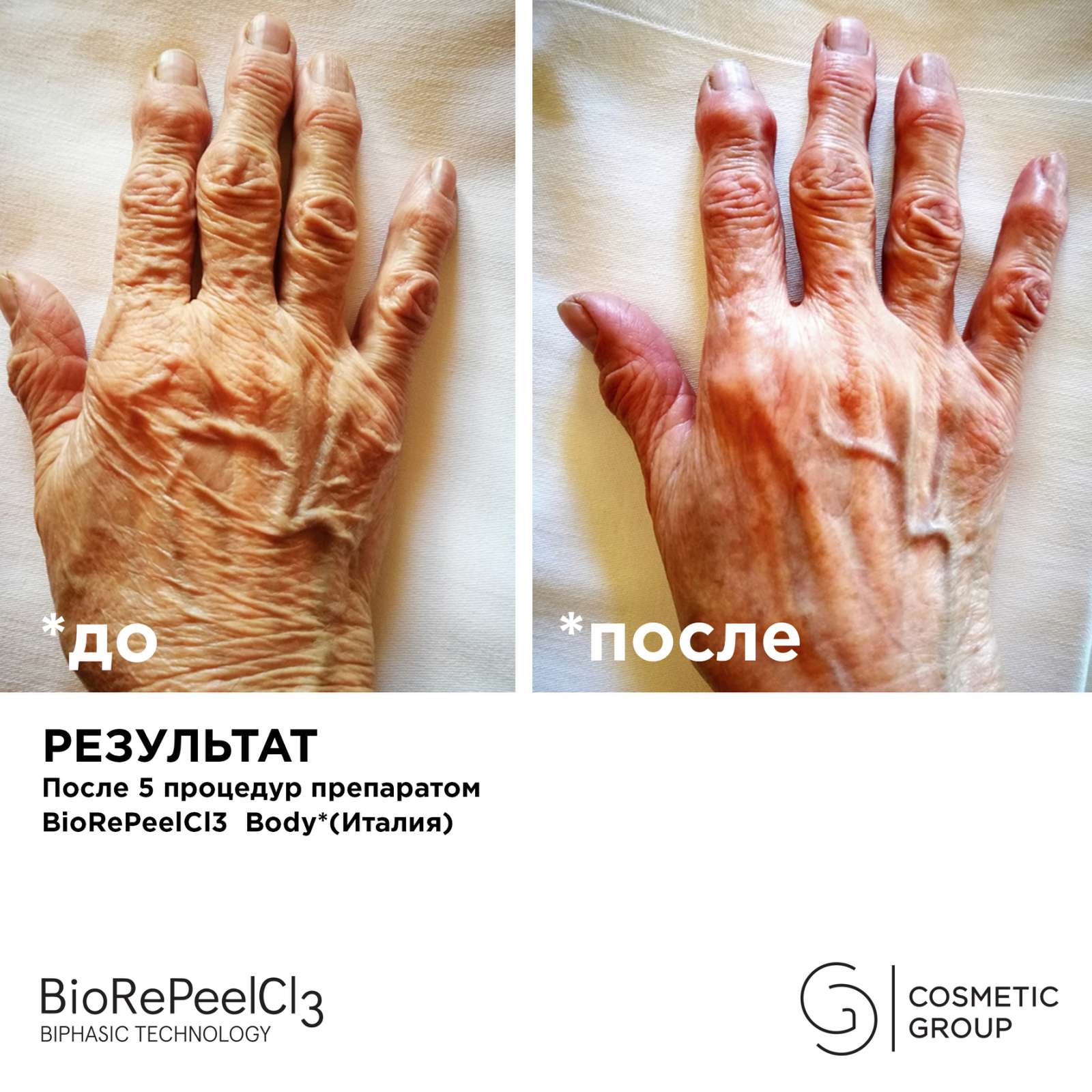 Пилинг BioRePeelCL3