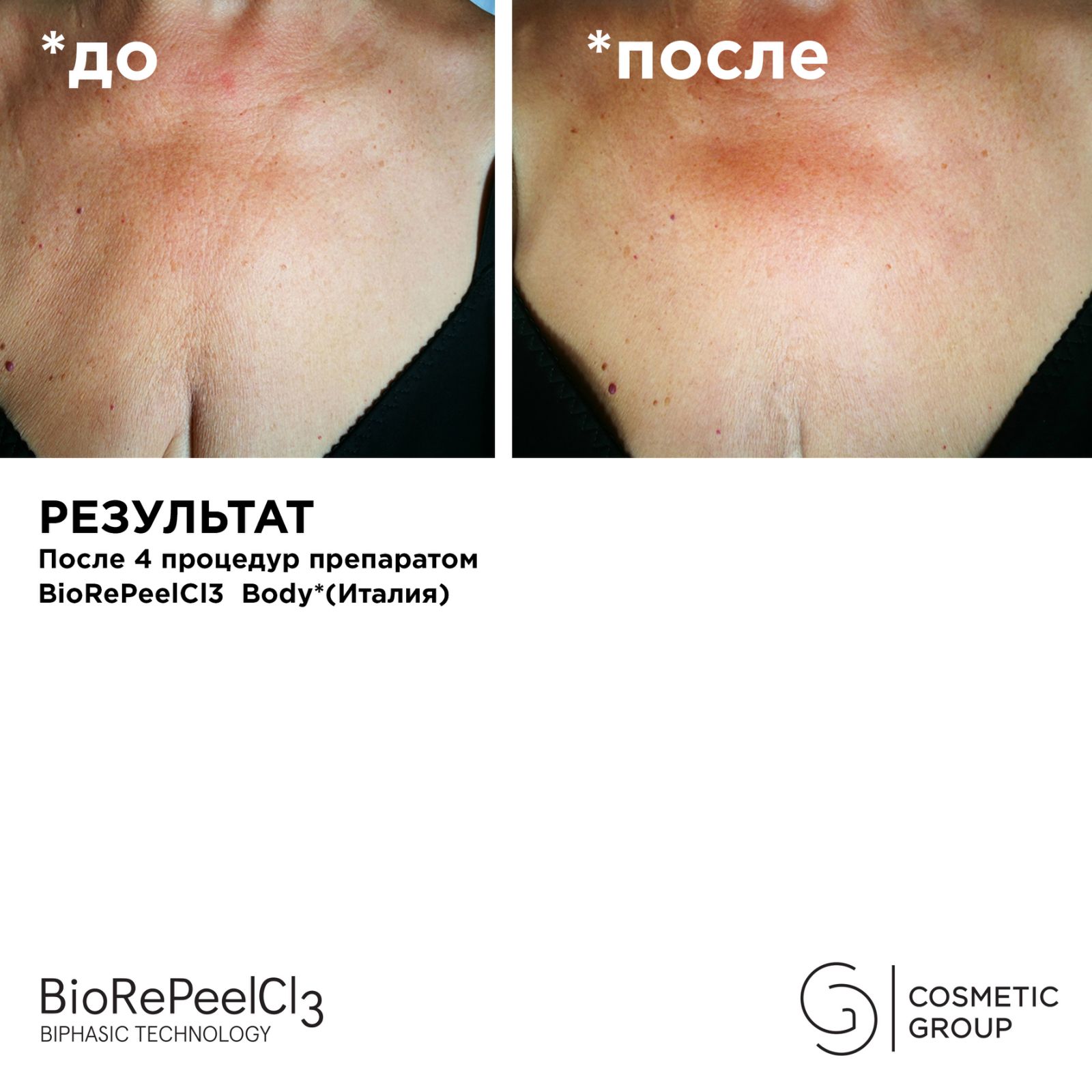 Пилинг BioRePeelCL3