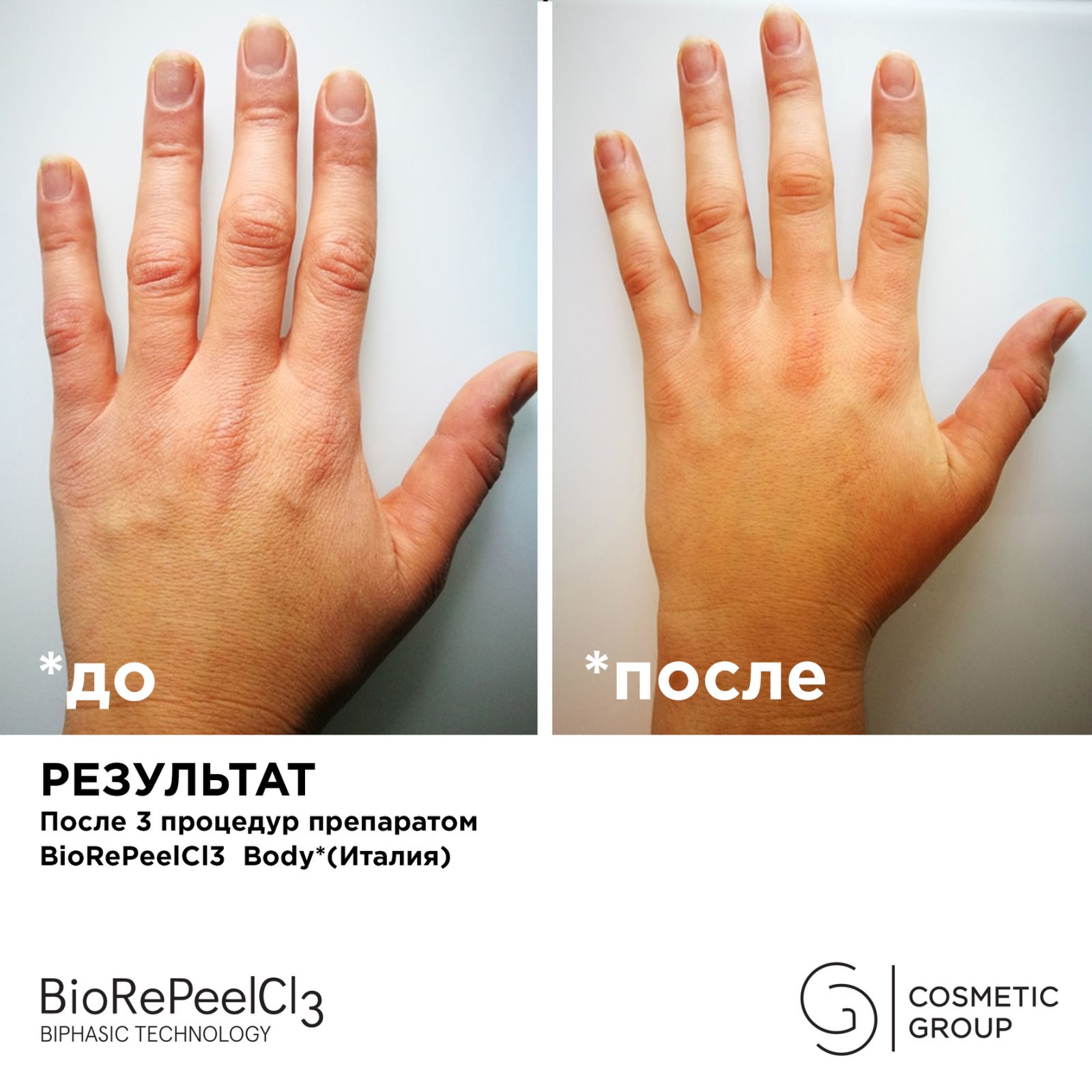 Пилинг BioRePeelCL3