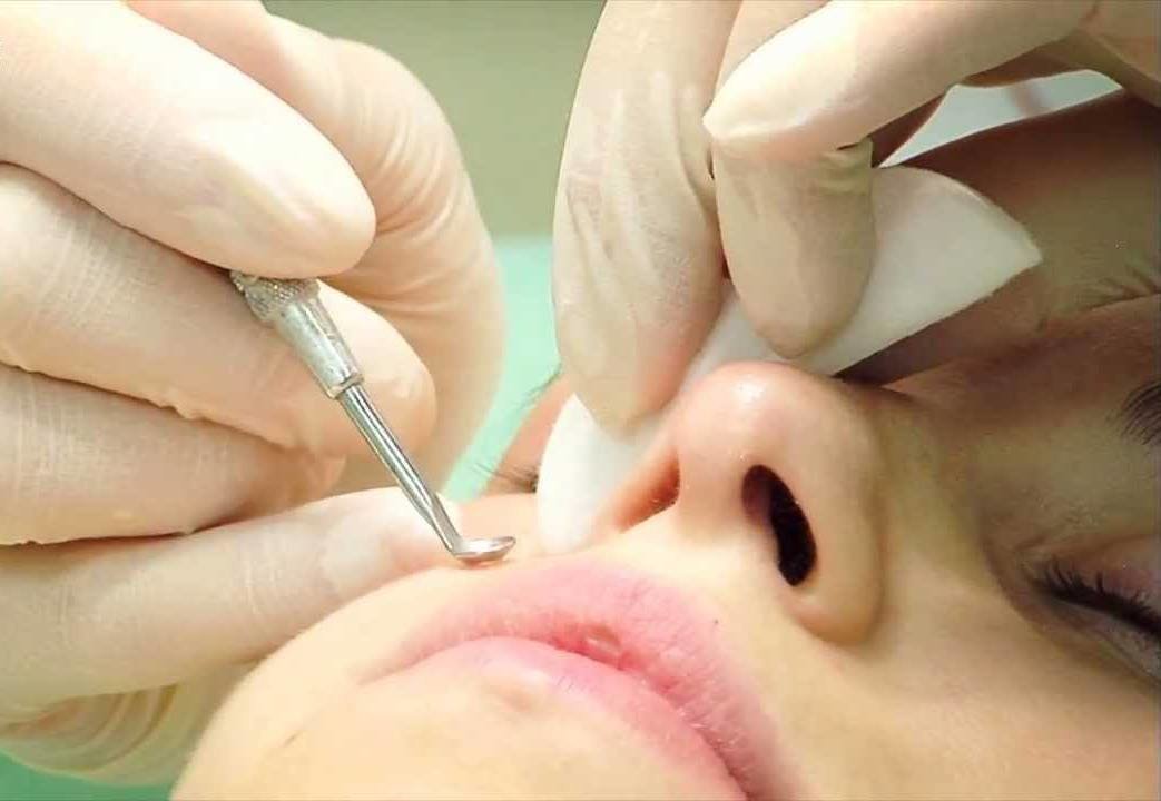 Гигиеническая (механическая) чистка лица